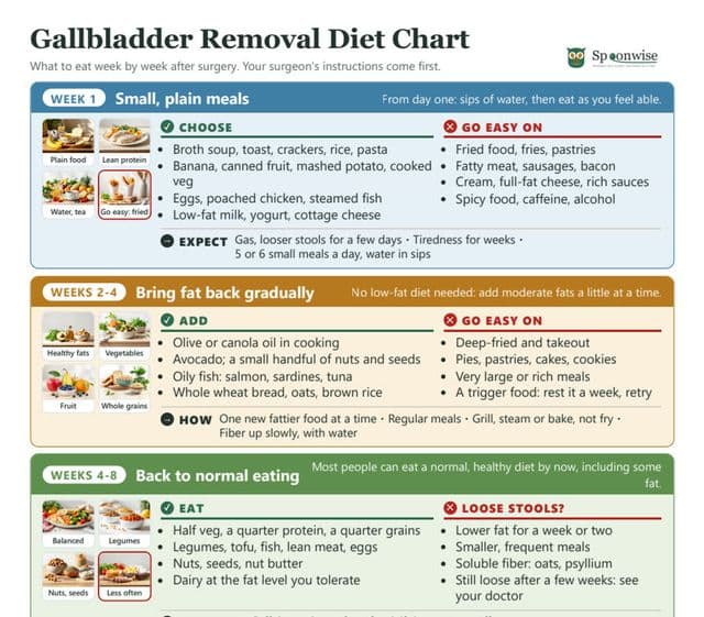 The top of the Spoonwise Gallbladder Removal Diet Chart: what to eat week by week after surgery.